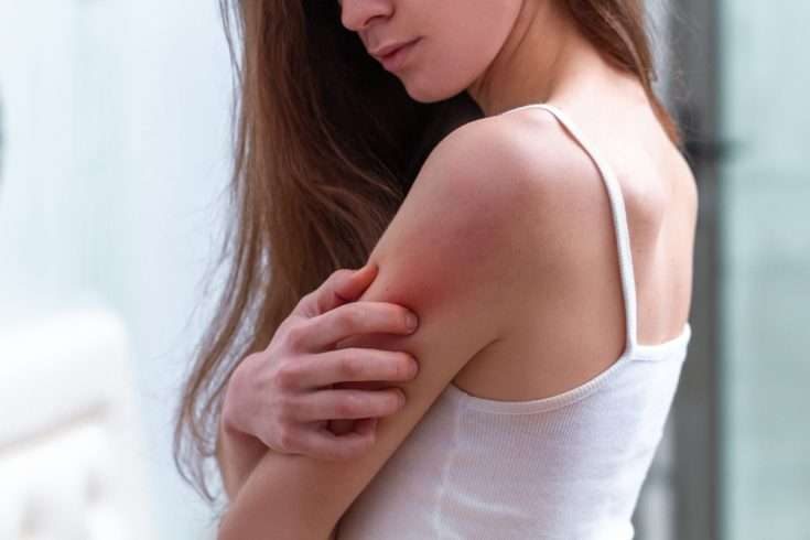 Skin rash on arm