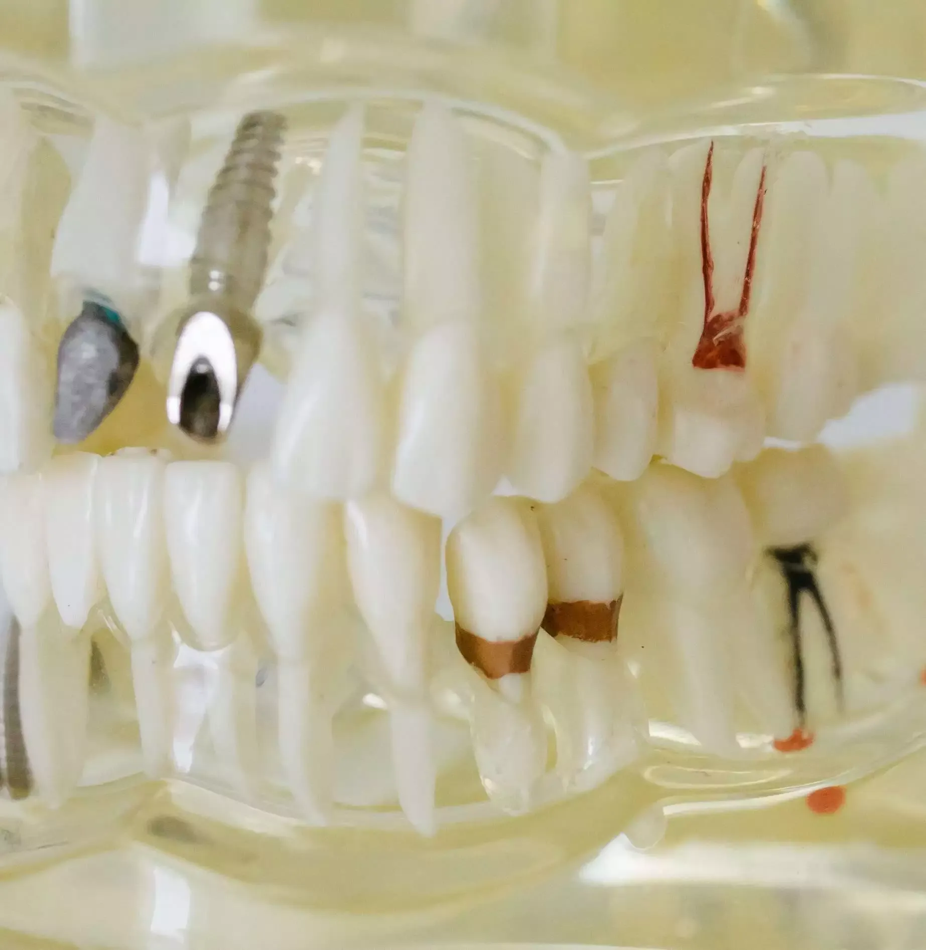 Dream of Teeth Falling Out: 14 Surprising Reasons Why You May Be Having This Dream 9 dream of teeth falling
