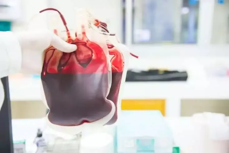 Lockdown Effect: Hospital uses 10 Units of Blood Everyday, Down from 40 6 Lockdown Effect: Hospital uses 10 Units of Blood Everyday, Down from 40 3
