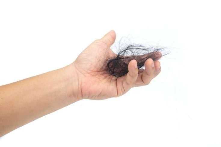 Trichotillomania: My Story 3 Trichotillomania: My Story 1