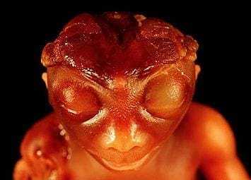 10 Weird Diseases Discovered in the World! 13 Weird Disease