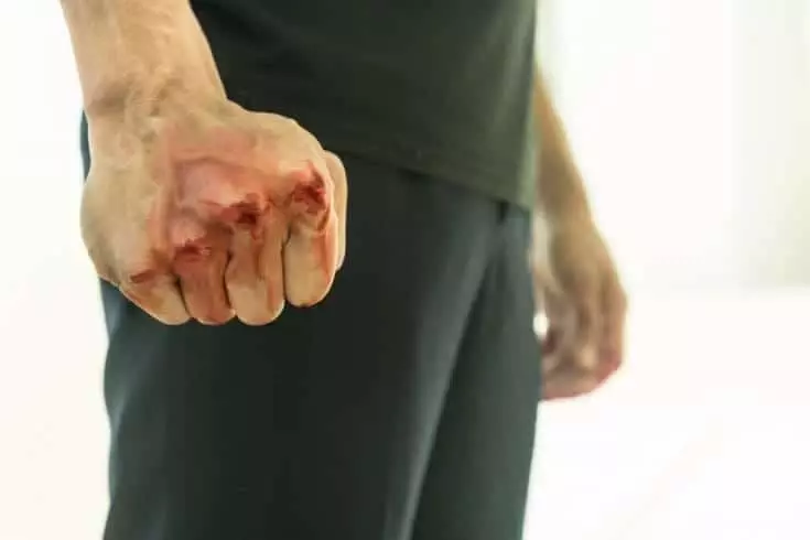 Aggressive man with bloody fist. Small Man Syndrome