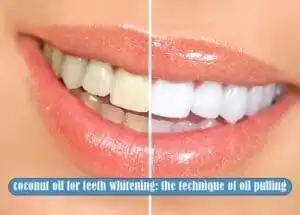 15 Best DIY Teeth Whitening Methods 3 Oil Pulling