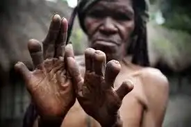 10 Bizarre Religious Beliefs Across the World 10 The fingers of this women are cut down