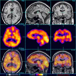 Advanced Radiology: Fun Facts 5 advanced radiology